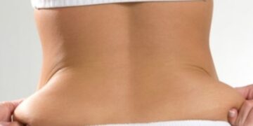 Έτσι θα απαλλαγείς από τα «ψωμάκια» στην περιφέρεια! Η απόλυτη δίαιτα για να δεις τη διαφορά στους πόντους!