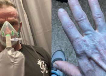 Ξύπνησε και ήταν όλος μπλε: Όταν πήγε στο νοσοκομείο οι γιατροί έκλαψαν από τα γέλια