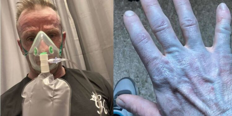 Ξύπνησε και ήταν όλος μπλε: Όταν πήγε στο νοσοκομείο οι γιατροί έκλαψαν από τα γέλια