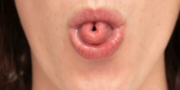 Τι σημαίνει ψυχολογικά η ικανότητα να διπλώνεις τη γλώσσα σου σε σχήμα «U»