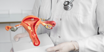 Αφαίρεση Πολύποδα Τραχήλου: Πότε Είναι Απαραίτητη η Απόξεση