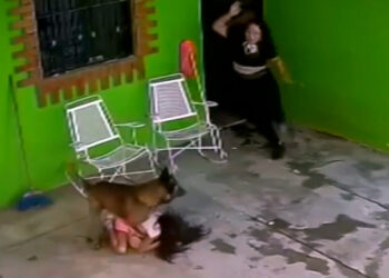 Τρομακτική επίθεση σκύλου σε 7χρονο: Την άρπαξε από το κεφάλι και την κουνούσε δεξιά-αριστερά (video)