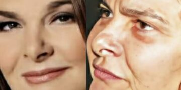 Αγνώριστη σήμερα στα 65 η πασίγνωστη τραγουδίστρια μεγάλων επιτυχιών