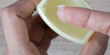 Alldaynews.gr Βαζελίνη: Οφέλη υγείας, χρήσεις – Τι θέλουν να γνωρίζετε οι δερματολόγοι