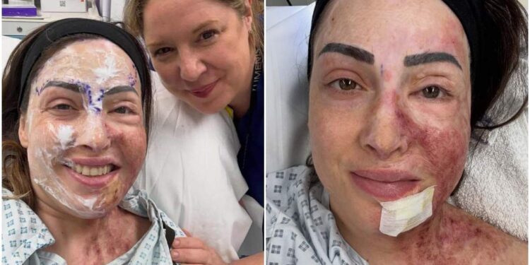 Φωτογραφίες σοκ από το πρόσωπο της Ιωάννας Παλιοσπύρου: Η ωμή αλήθεια χωρίς φίλτρα – «Δεν είναι όμορφο, πονάει, αλλά χτίζω τον εαυτό μου ξανά»