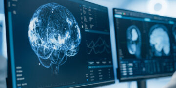 Τι είναι το «θαυματουργό» γραφένιο που φέρνει ελπίδα για Πάρκινσον και επιληψία