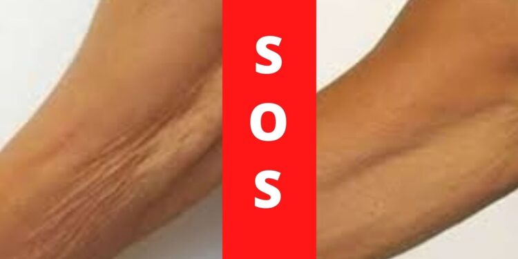 Γιατί τα μπράτσα «χαλαρώνουν» πιο εύκολα μετά τα 50 και τι μπορείτε να κάνετε;