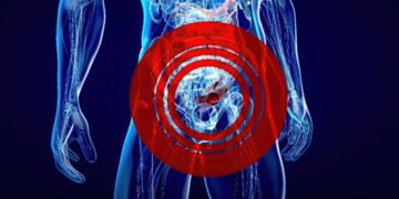 Τι είναι η υπερπλασία προστάτη και πώς αντιμετωπίζεται;