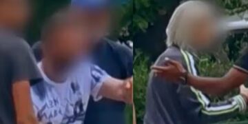 Ξυλοδαρμός στην Καλλιθέα: Ο 21χρονος μιλάει για την άγρια επίθεση του οδοντιάτρου – «Του φώναζα να σταματήσει.. δεν άκουγε τίποτα»