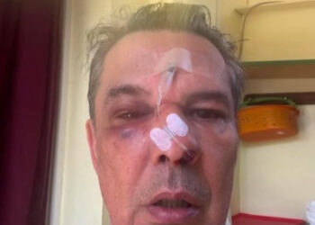 Ξυλοδαρμός σε ιατρείο – Του μαύρισε το μάτι και τον έστειλε στο νοσοκομείο για ασήμαντη αφορμή (video)
