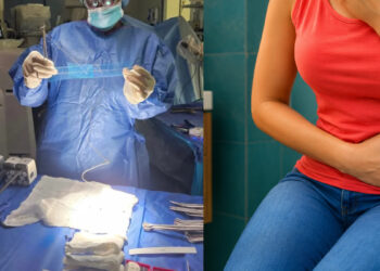 Για 10 χρόνια έβγαιναν τα όργανά της κάθε φορά που πήγαινε στην τουαλέτα – Οι γιατροί δεν την πίστευαν – «Σαν το κεφάλι ενός μωρού»
