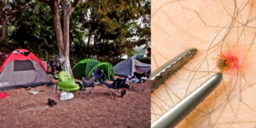 Alldaynews.gr Πήγε για κάμπινγκ με φίλους και πέθανε από ένα λουκάνικο – Το τσίμπημα που δεν ήξερε ότι είχε καταδικάσει τη ζωή του