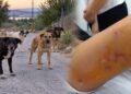 Αγέλη αδέσποτων σκυλιών επιτέθηκε και τραυμάτισε 12χρονη – «Είναι σοκαρισμένη, δεν έχει ηρεμήσει», λέει ο πατέρας της