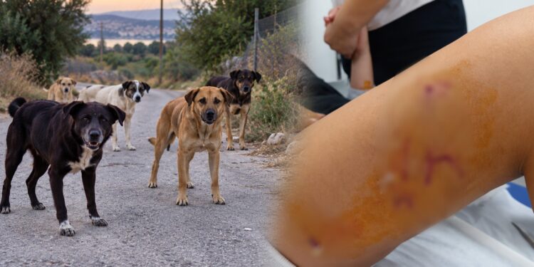 Αγέλη αδέσποτων σκυλιών επιτέθηκε και τραυμάτισε 12χρονη – «Είναι σοκαρισμένη, δεν έχει ηρεμήσει», λέει ο πατέρας της