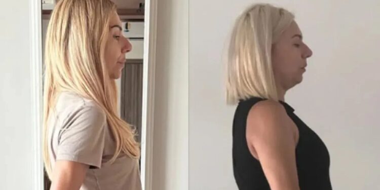 Τίνα Μεσσαροπούλου: «Κι όμως, είμαι εγώ 6 χρόνια πριν» – Πώς άλλαξε ολοκληρωτικά την εμφάνισή της! Το πριν και το μετά (Φωτογραφία)