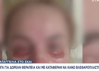 Χαμός σε γνωστό Ινστιτούτο: «Με έκαψε τόσο βαθιά που μέχρι και σήμερα υποφέρω» – Ανειδίκευτος ο γιατρός που έκανε βλεφαροπλαστική – Δουλεύει κανονικά η κλινική (video)